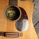 Martin DCX1E