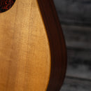 Martin DCX1E